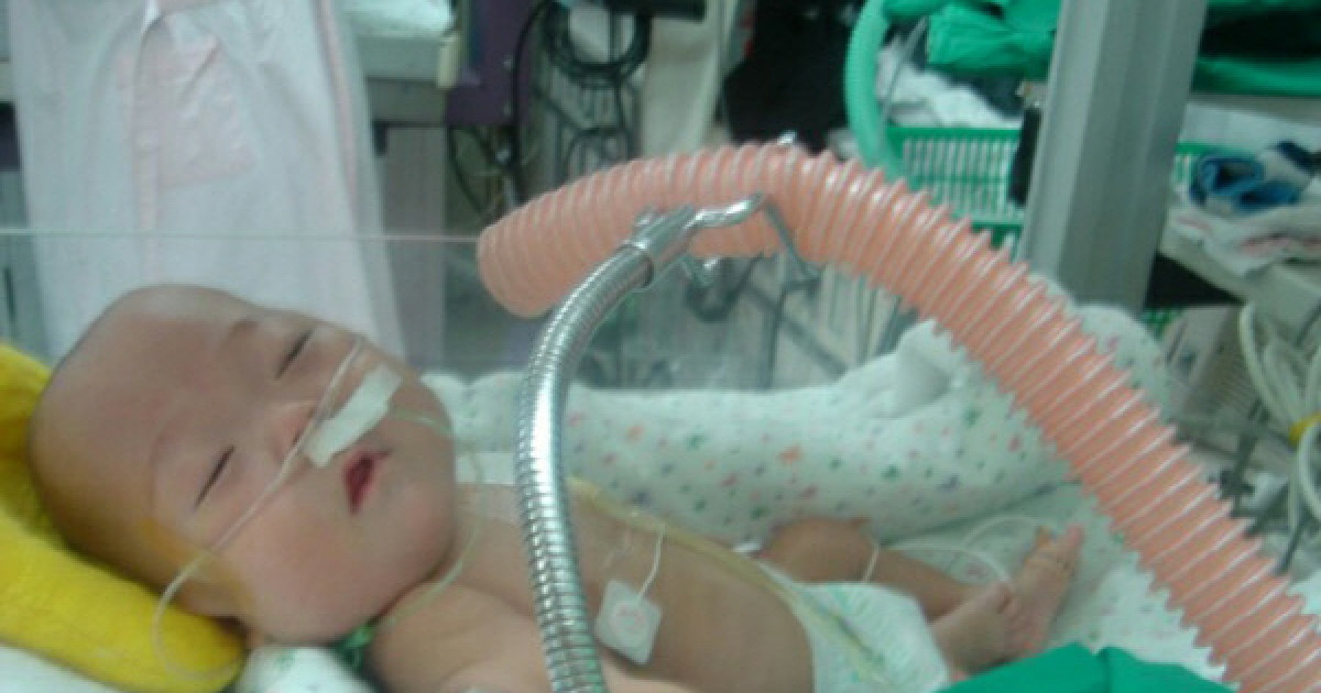 [Humidifier Sterilizer Scandal] Circumstances Suggest Sterilizer Caused