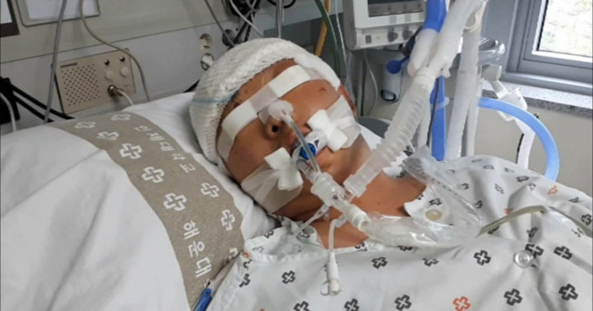 음주 교통 사고로 의식 잃은 윤창호씨 사망