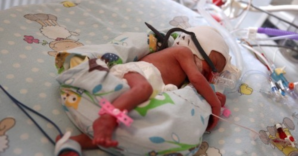 POLAND SEXTUPLETS BORN IN KRAKOW
