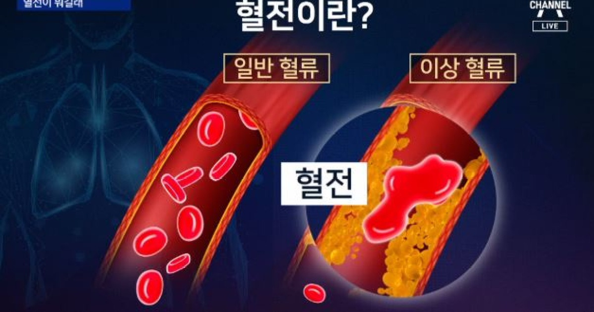 혈전 발생 국내 2번째..아스트라제네카 어떻게 될까