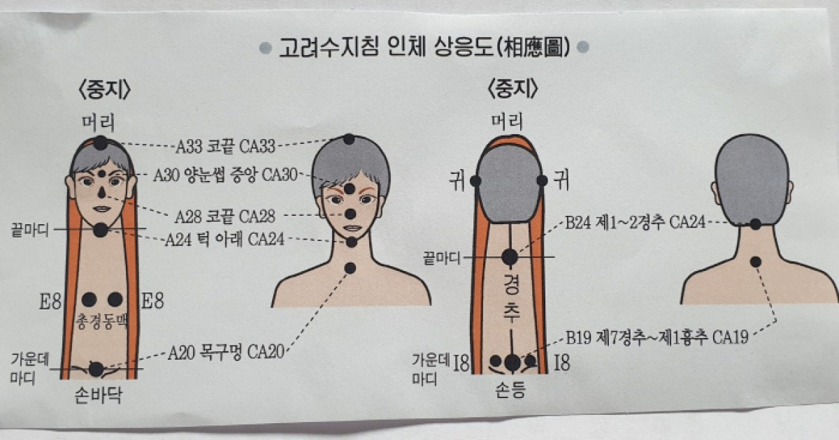 콧물·재채기·코막힘, 서금요법으로 자극하면 증상 해소