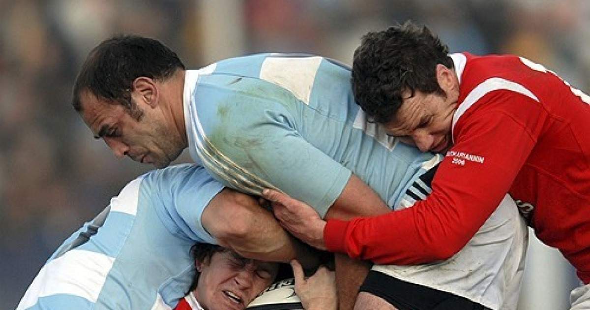 RWC Rugby Head Injuries