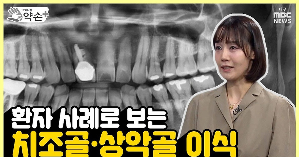 [약손+] 뿌리부터 튼튼, 제3의 치아 '임플란트' ⑨뼈 이식 사례
