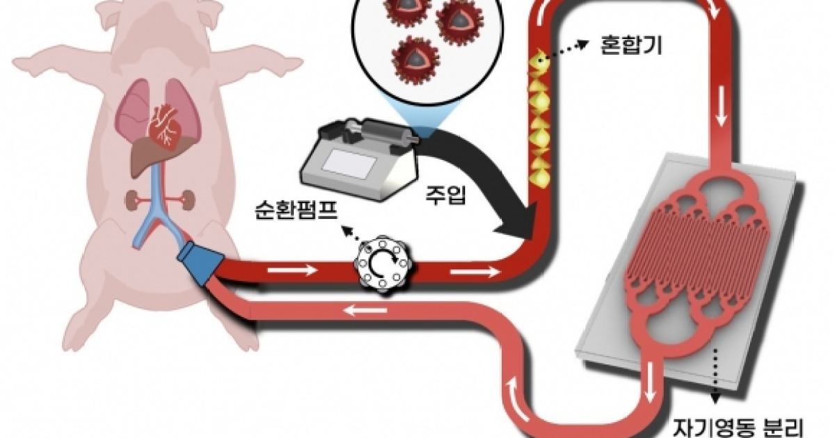 국내 연구진, 패혈증 원인균 자석으로 정화 기술 개발