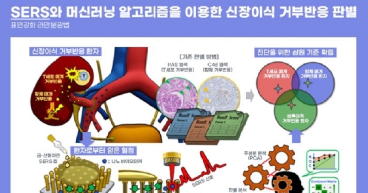 신장이식 거부 반응, 피 한 방울로 진단 가능해진다
