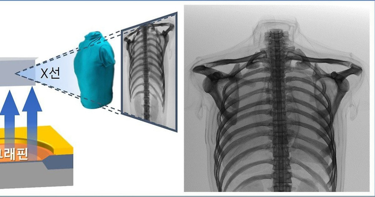 그래핀 반도체로 만든 X선 장비 나왔다…의료용 영상 촬영 세계 최초 성공