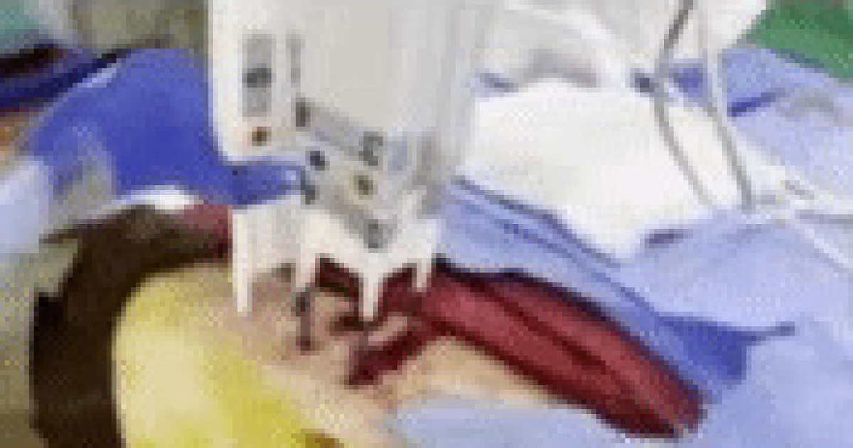 Pancreatic Cancer Treatment Boosts Survival - News Directory 3