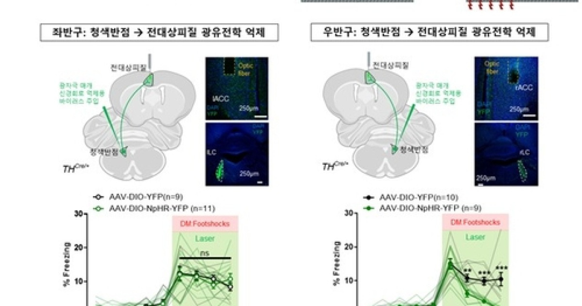 고통 공감은 오른쪽 뇌에서...'좌뇌 논리·우뇌 감정' 확인