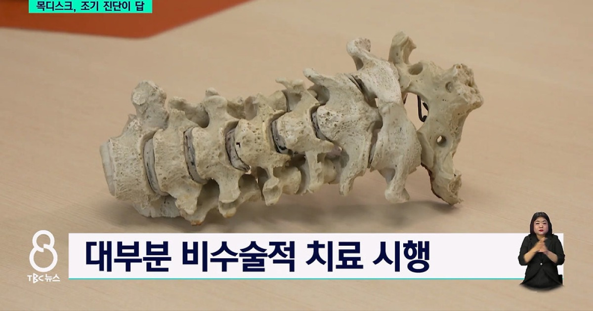 [닥터리포트]목디스크 가대 신경외과 이종운