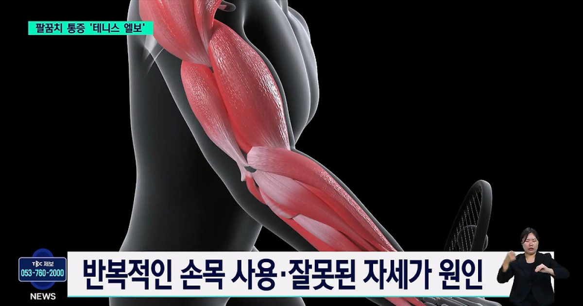 [닥터리포트]테니스엘보 가대 마취통증의학과 김동혁