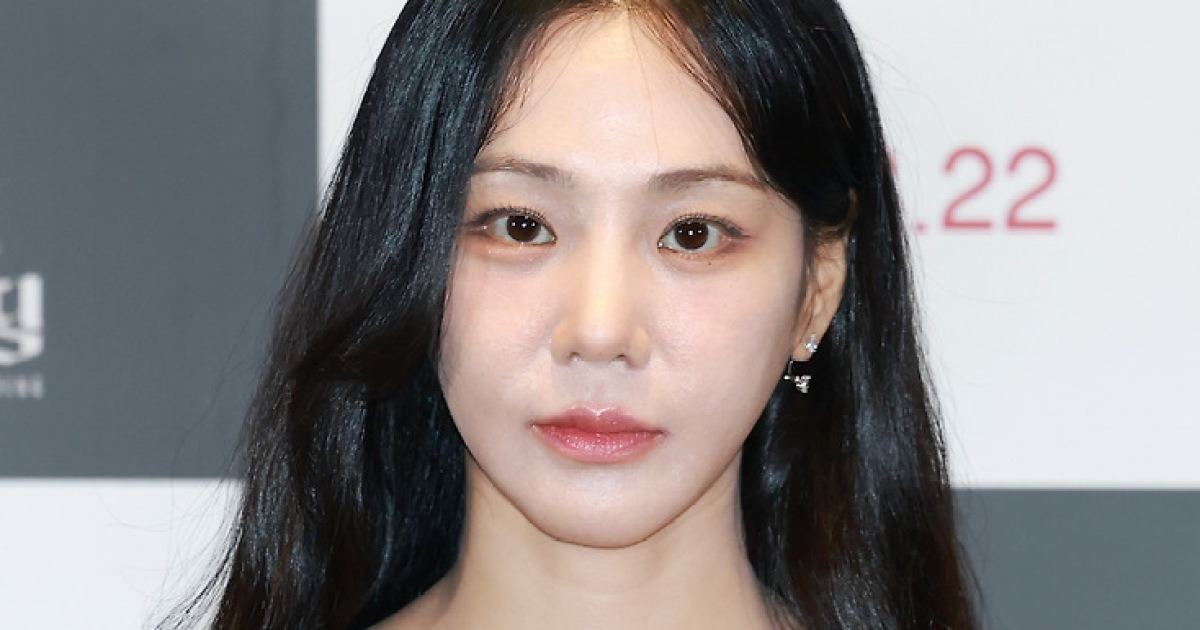 "근황 보여달라"…한지은, 반려 도마뱀 학대 의혹 해명에도 논란 여전 [N이슈]