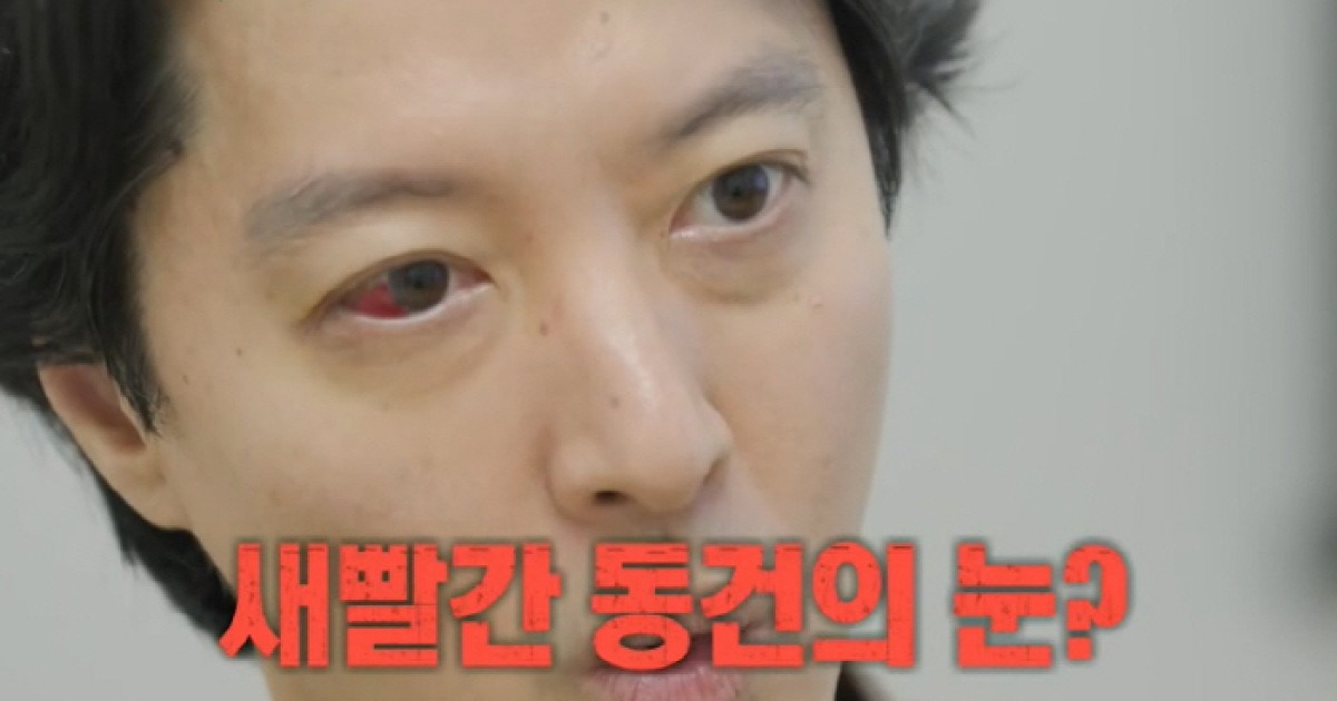 '조윤희 이혼' 이동건 '새빨간 눈' 희귀병 충격 "송곳으로 찌르는 고통"