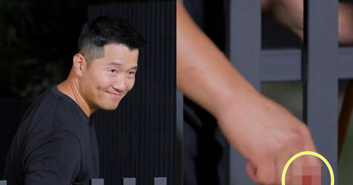 강형욱, 개물림 사고 당했다…"안락사 시켜야 하나 고민" ('개늑시')