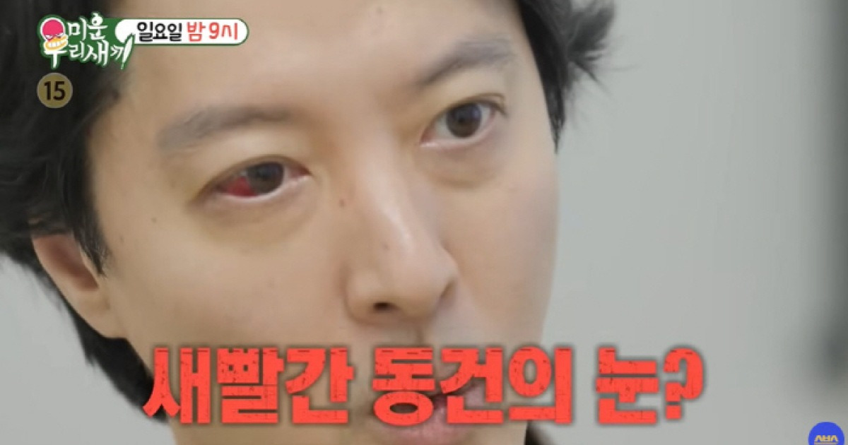 이동건, 새빨간 눈으로 병원行...희귀병인가 "숨만 쉬어도 찌르는 느낌" ('미우새')
