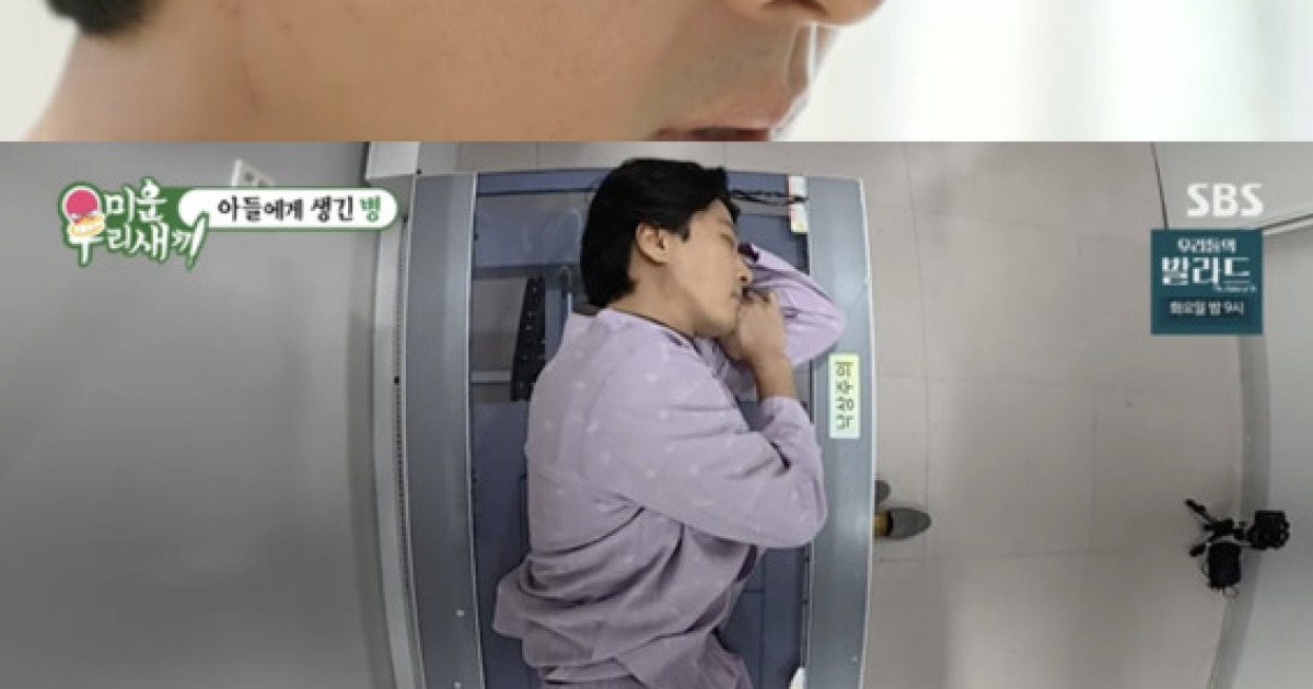 이동건, 인구 1% 희귀병 '강직성 척추염' 진단.."완치 불가"[미우새][★밤TView]