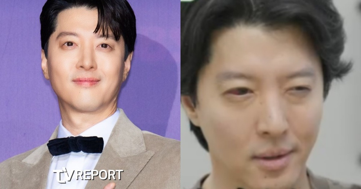 이동건, 1% 희귀병 진단→완치 불가…"평생 관리 필요" ('미우새')