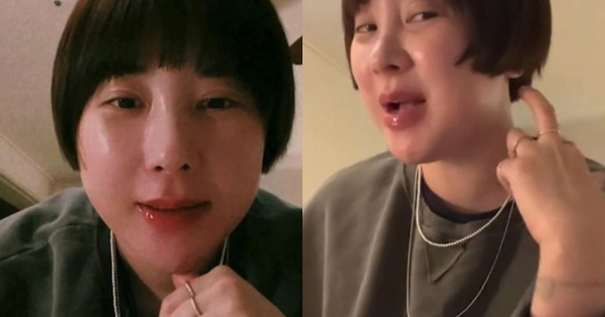 서인영, 10kg 증량·성형 부작용 고백···“컴백은 살 빼고”