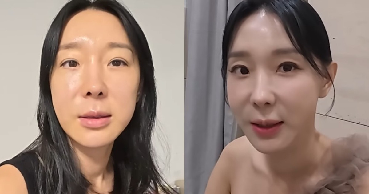 '45세' 이지혜, 얼굴 싹 손봤다…"성형 과감히 오픈" [RE:뷰]