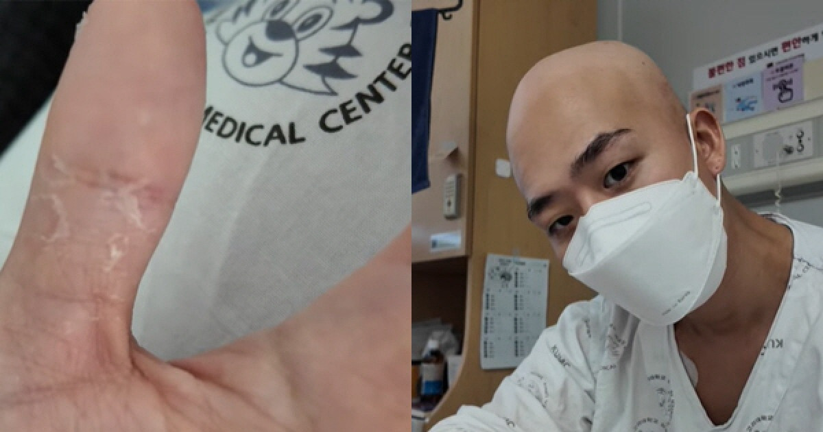 '선미 댄서 출신' 차현승, 백혈병 투병 근황 “피부 벗겨지고 수치 안 올라”