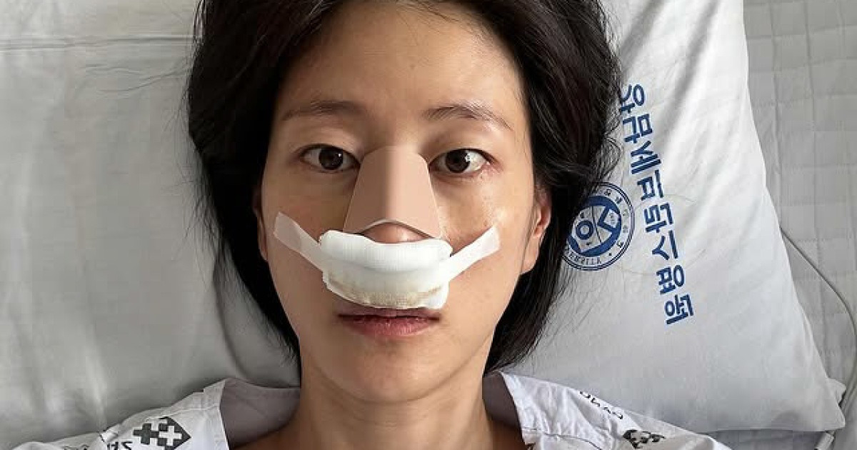 이현이 "축구하다 코뼈 부러져 입원…인생 첫 깁스"
