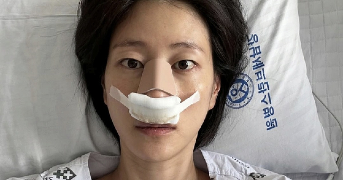 이현이, 축구 하다 코뼈 골절까지 “인생 첫 깁스”