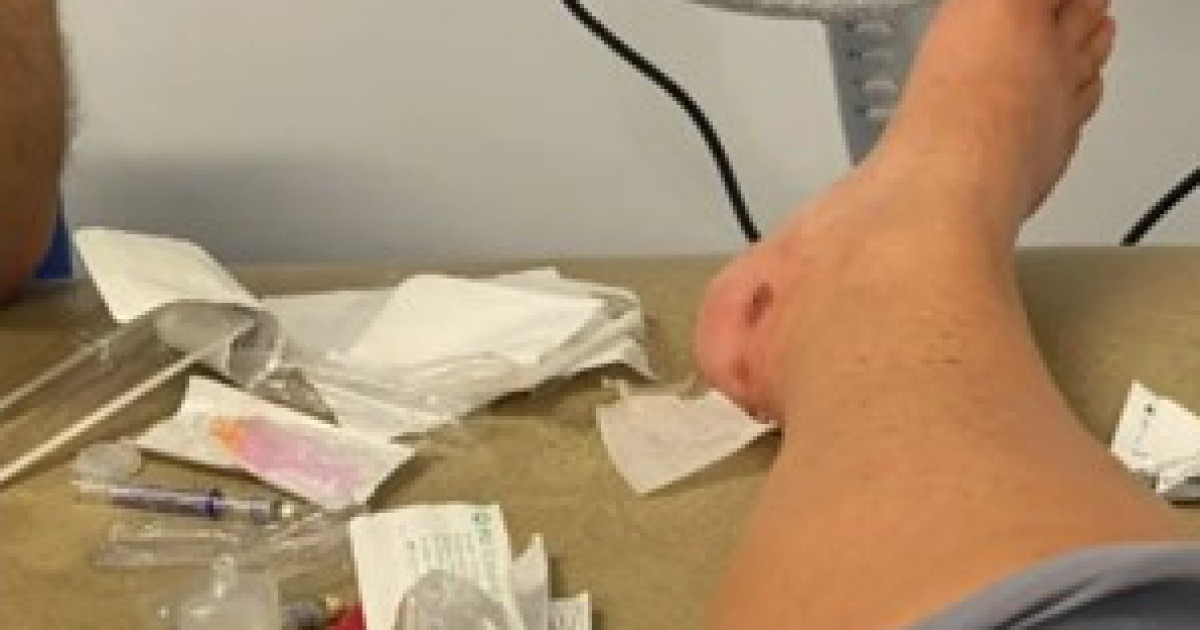 대수롭지 않게 여긴 길고양이 물림 상처…상처에 짖는 반려견 때문에 병원 갔더니