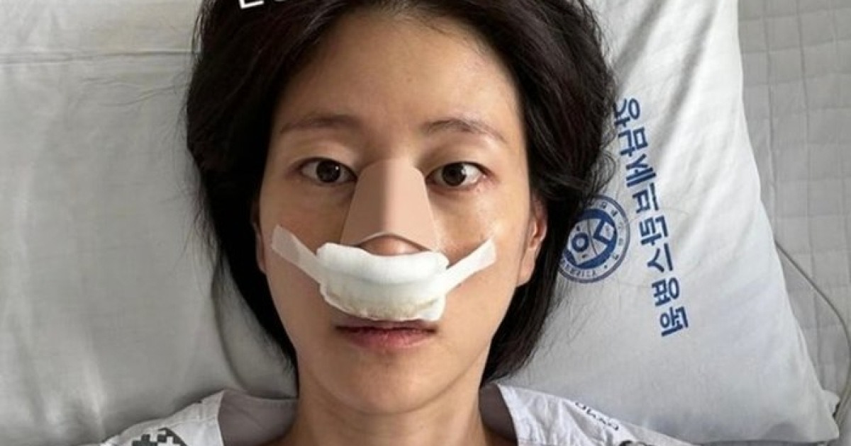 이현이, ‘골때녀’ 경기 중 코뼈 골절