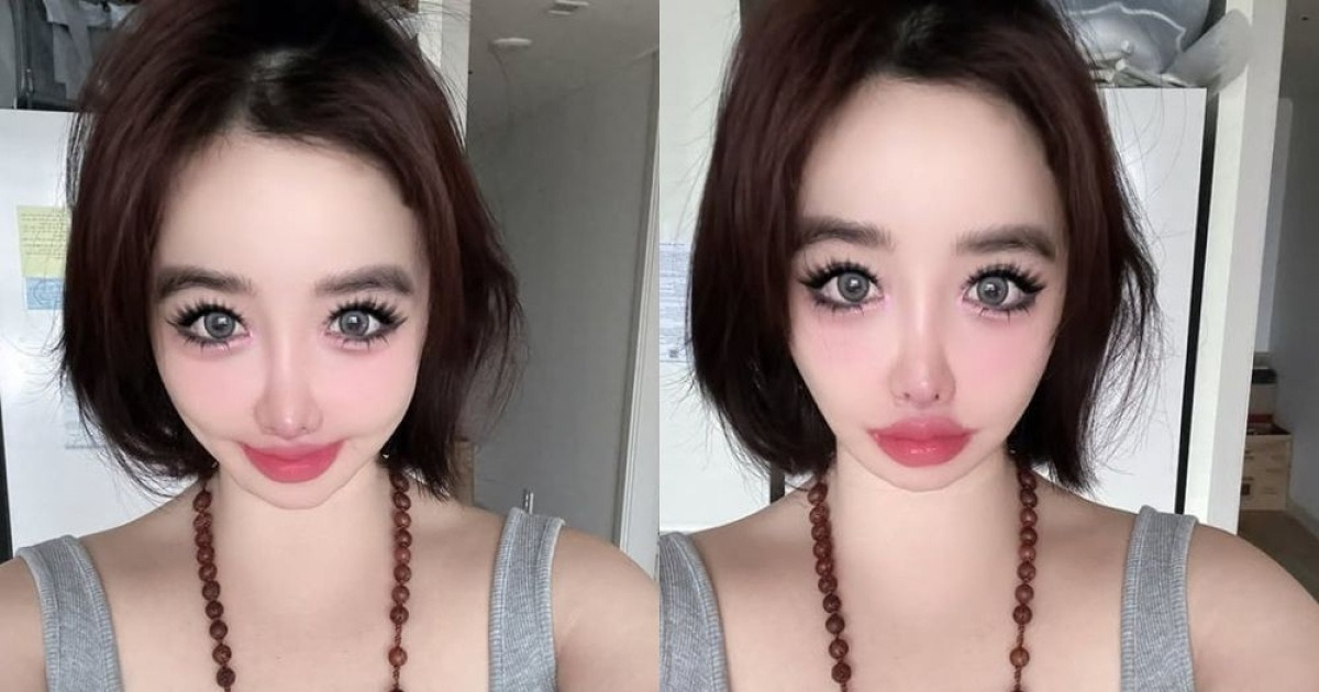 체중 감량 후 근황
