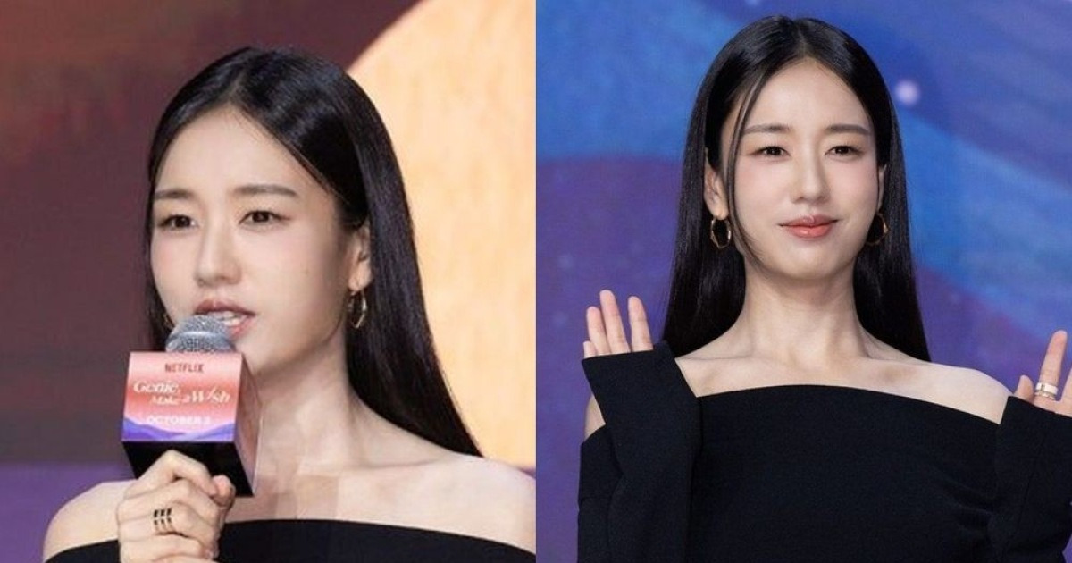 안은진, 눈부신 비주얼…