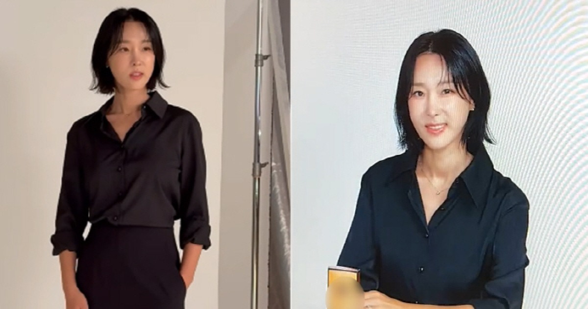 이지혜, '실리프팅' 시술 후 확 달라진 얼굴...