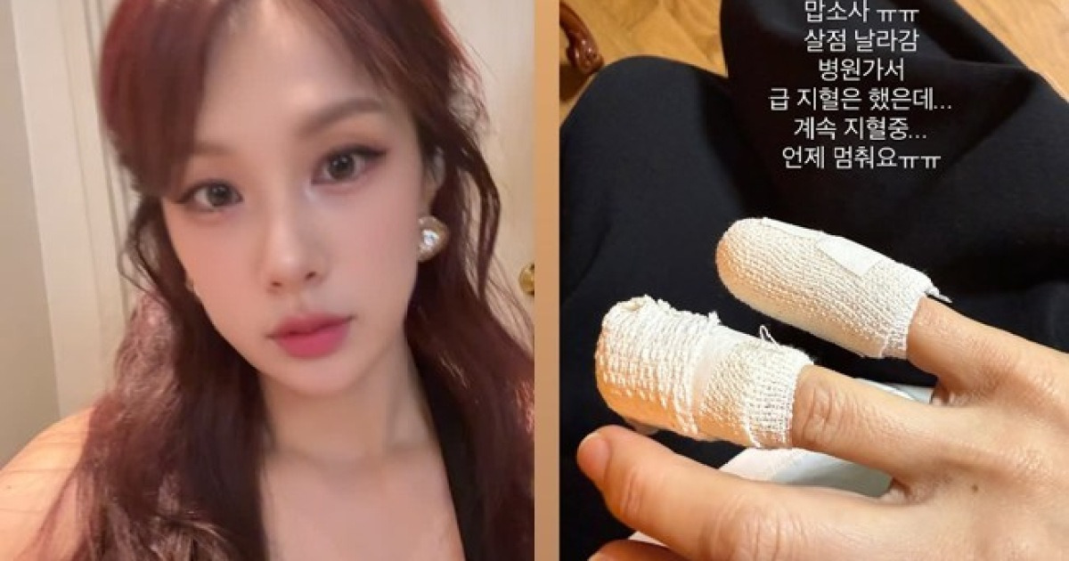 채연, 부상으로 급히 병원行 “살점 날아가, 계속 지혈 중”