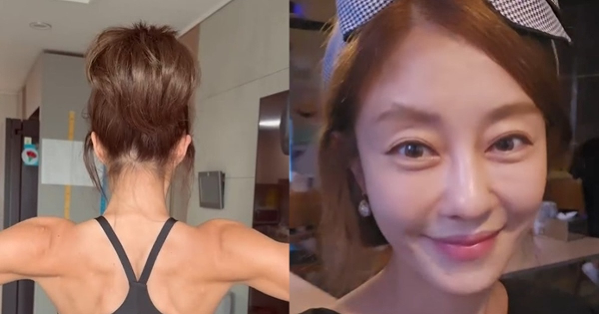 몸에 하얀 점이…이지현, 난치병 고백 "기술 얻은 대신 백반증 얻어"