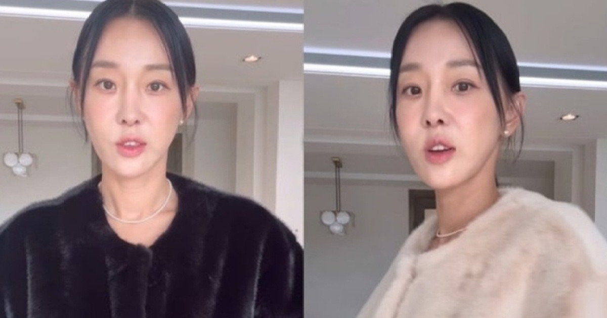 이지혜, 인중 축소술 근황…달라진 미모