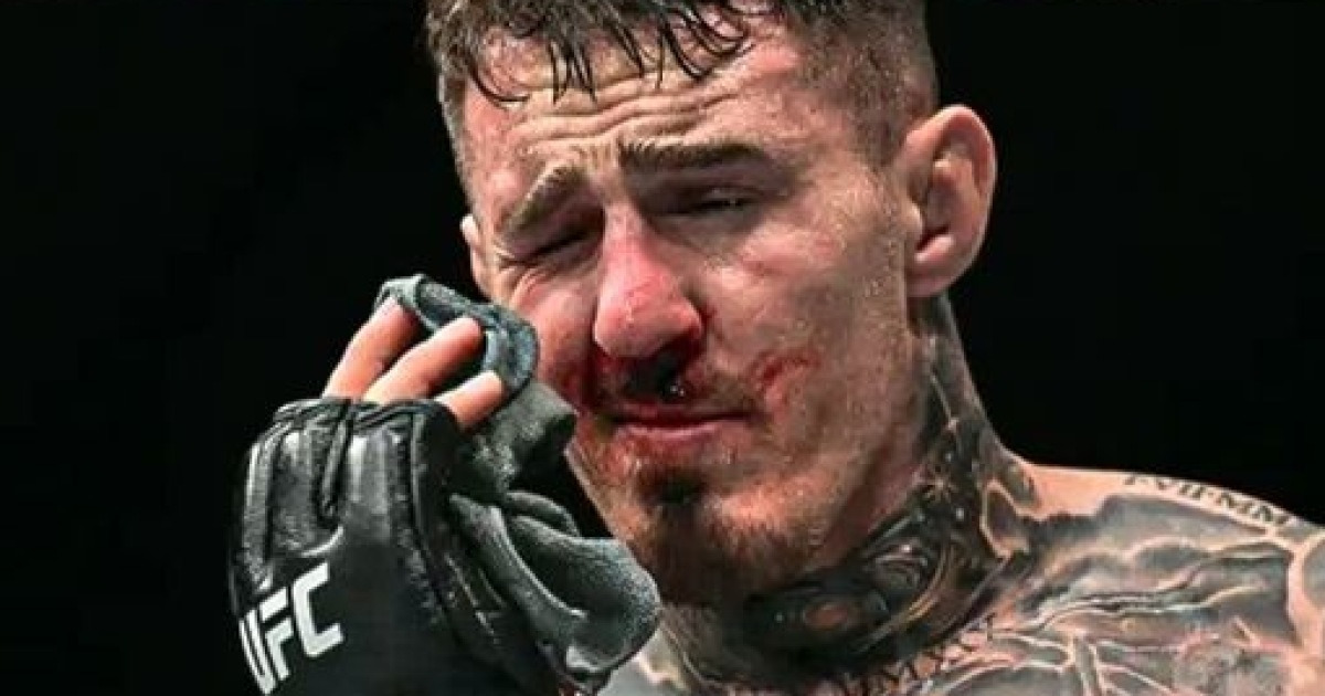 UFC 저격에 아스피날, 진단서 공개..."복시와 안구 운동 불능, 사실상 맹인"