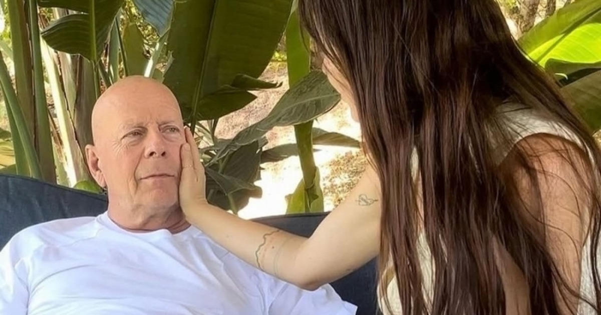 사후 뇌 기증 관련 국내 보도 이미지