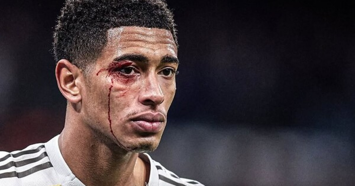 '벨링엄 출혈·2명 퇴장·19년 만의 참패' 최악의 하루 보낸 레알 마드리드...'라이벌' 바르셀로나와 우승 경쟁 적신호