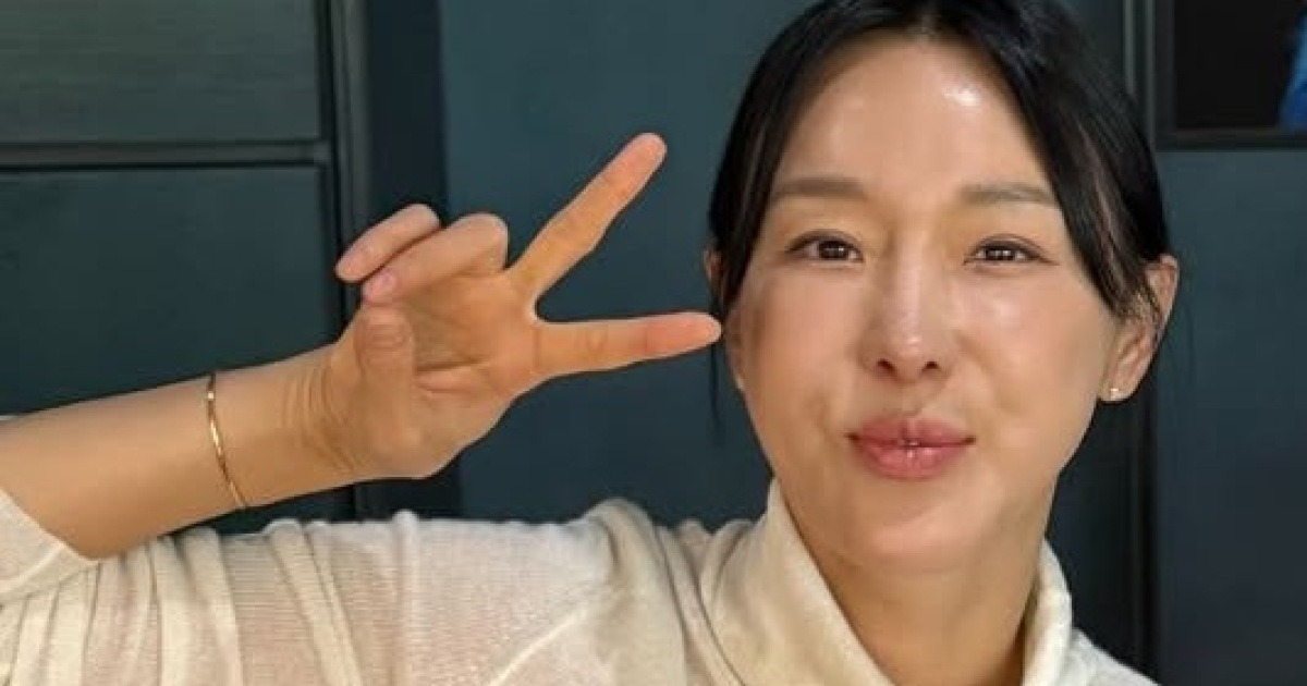 이지혜, 인중축소술 한 달 지난 근황 "이제 입 닫아짐"