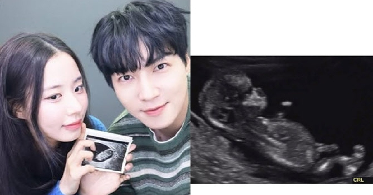 최현석 셰프, 할아버지 된다…최연수♥김태현, 결혼 3개월만 임신