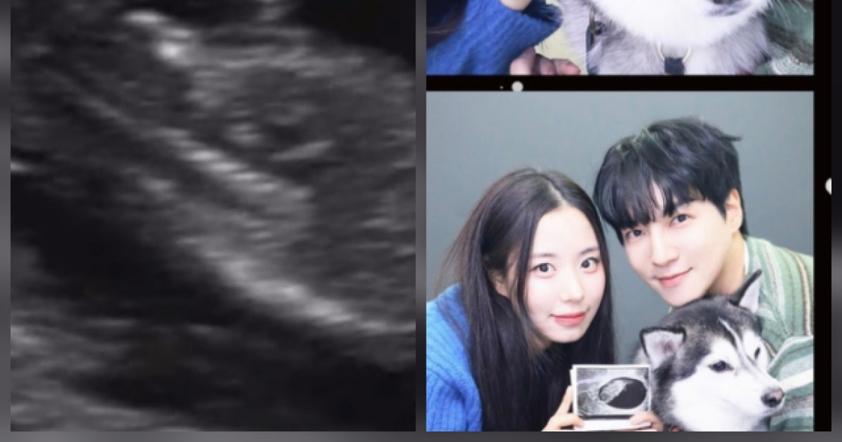 “결혼 3개월 만에 임신”…최현석, 딸 최연수 ‘허니문 베이비’에 할아버지 됐다