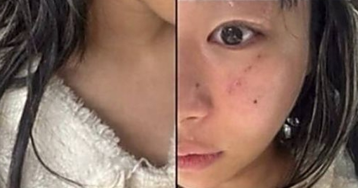 재키와이, '전 남친' 방달 데이트폭력 폭로..소속사도 나섰다 "법률 지원"(종합) [공식]