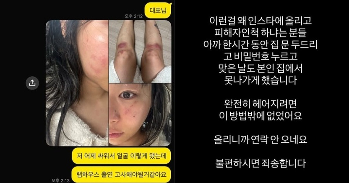 "부엌칼까지" 데이트 폭력 폭로한 女 래퍼…AOMG "법적 절차"→前남친 댓글창 폐쇄 [종합]