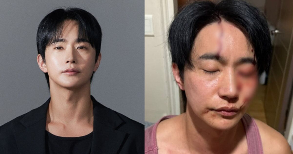 전호준 “전연인 폭행 의혹 벗었다, 난 피해자”