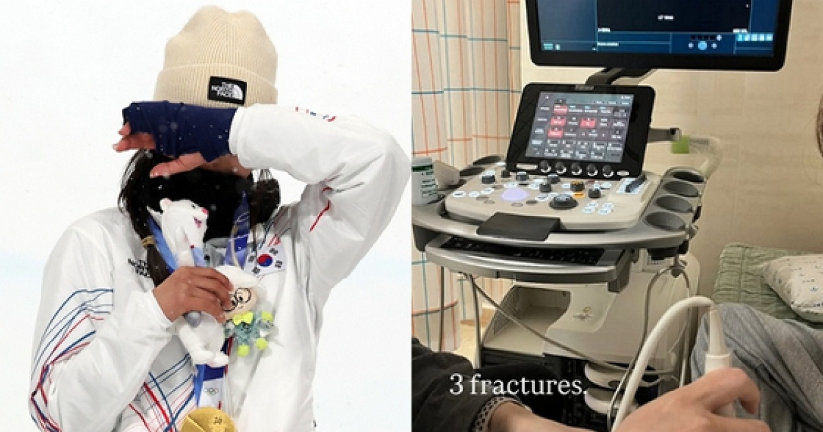 골절 상태로 금메달 땄나…'쿵' 넘어진 최가온 "3곳 골절"