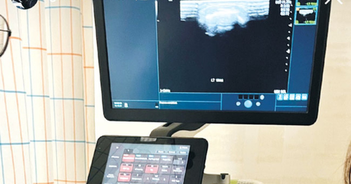 金 잡은 최가온, 경기때 손바닥뼈 3개 골절돼 있었다[2026 밀라노·코르티나 동계올림픽]