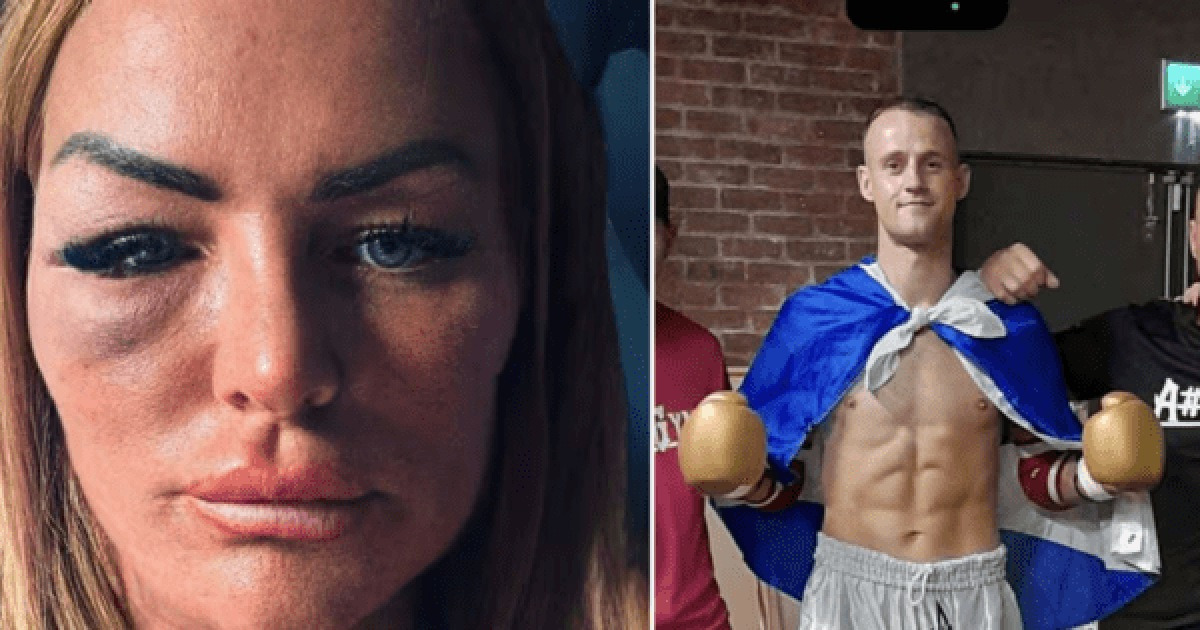 '격투기 선수, 무차별 폭행→두 아이 엄마, 삶 무너져'...뇌 손상·발작 후유증·12년 사업 폐업까지, "내게 모든 걸 뺏어갔다"