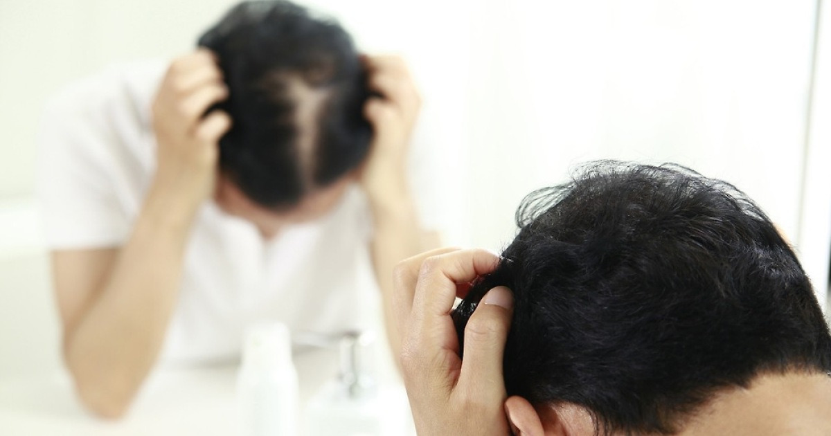 Pharmacist Reveals: Early Hair Loss in Youth – Stress & Thinning Hair - News Directory 3