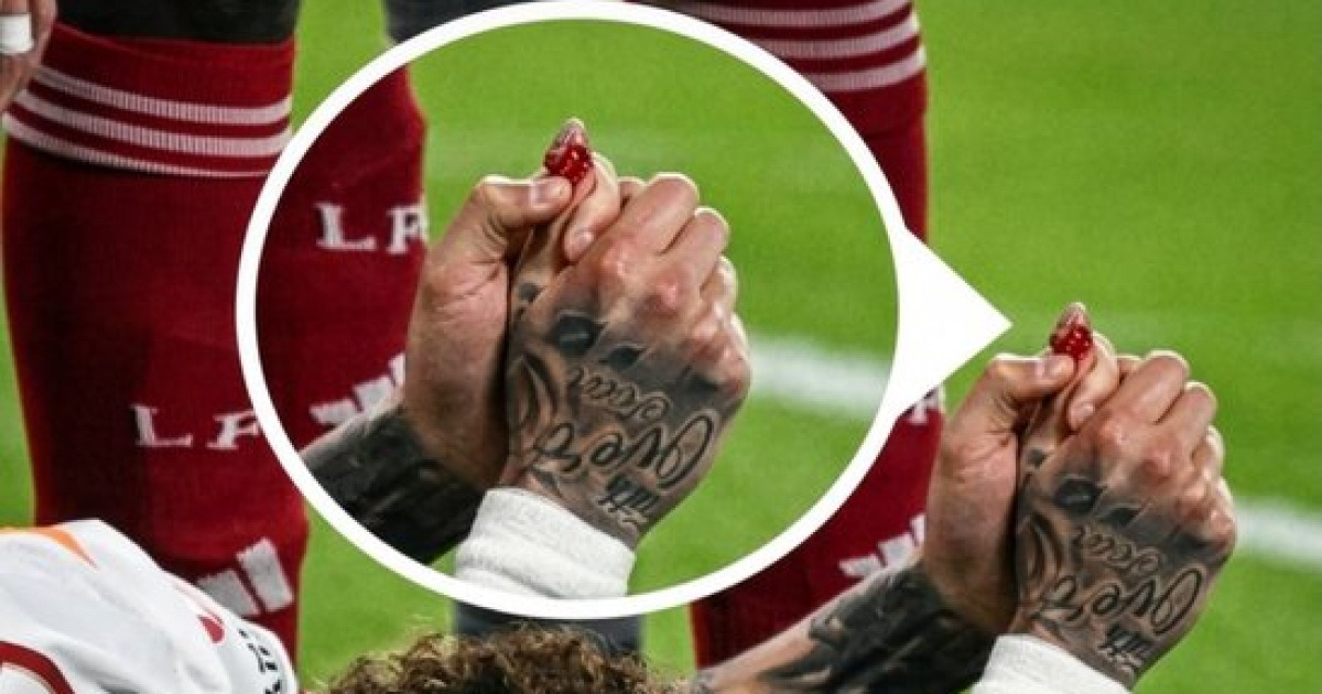 "손가락 절반이 찢겨져나가" 대참사...엄지 절단 직전 기적 생존에도 여전히 일상생활 사실상 불가능→"샤워도 도움 받아야"