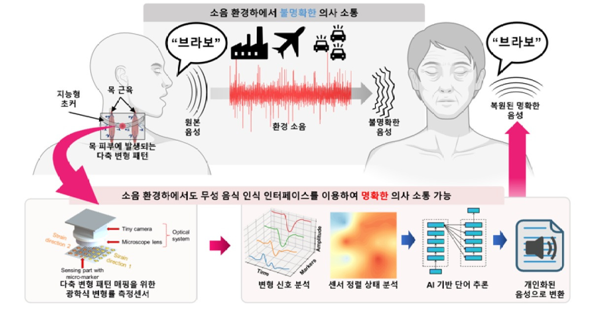 “목소리 없이도 소통 가능” AI로 목소리 되살린다