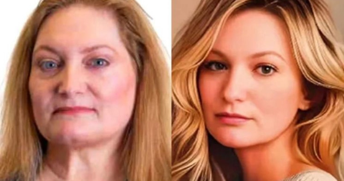 "눈 색깔마저 다르다" AI 보정 사진에 당에서 제명된 네덜란드 시의원