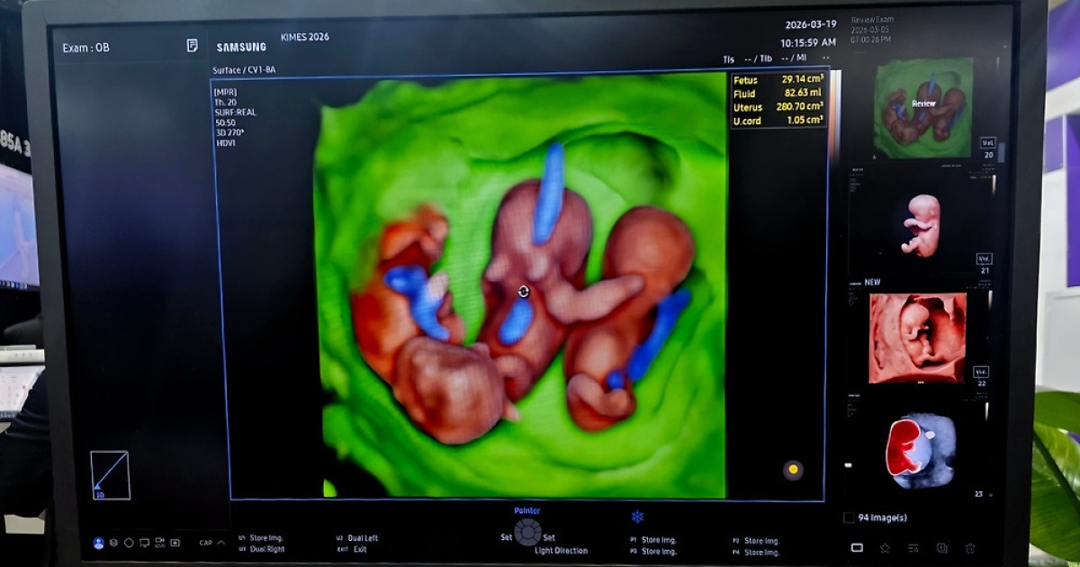 AI가 진단 넘어 소견서까지 쓴다... 국내 의료 AI 3년 새 2.5배 급증